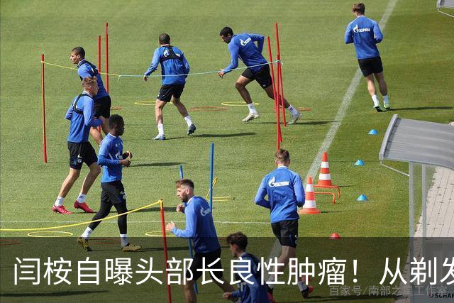 闫桉自曝头部长良性肿瘤！从剃发上手术台到《嫁金钗》播出